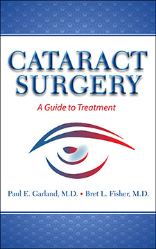 Cataract Surgery, A Guide to Treatment